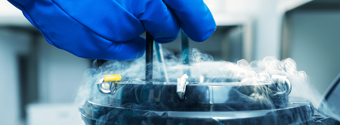 Egg Freezing Clinic in London, UK King's Fertility Clinic