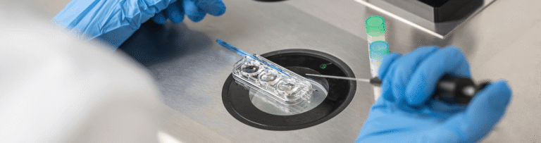 Kings Fertility Services - Additional lab techniques