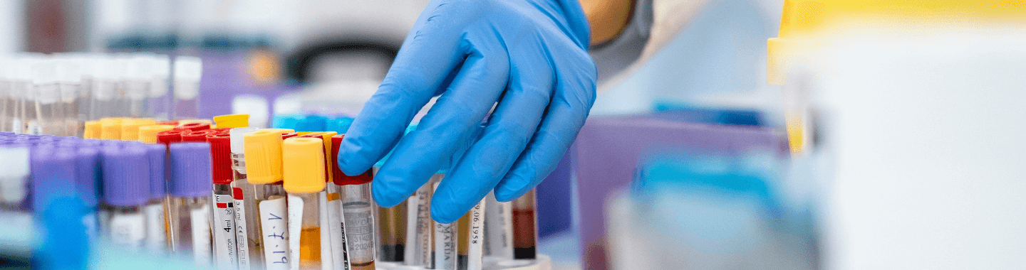 Kings Fertility Services - Blood Tests