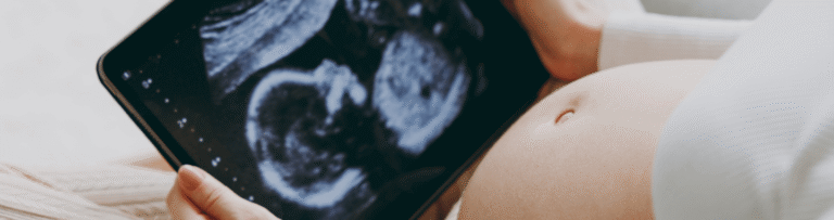 Kings Fertility Services - Surrogacy