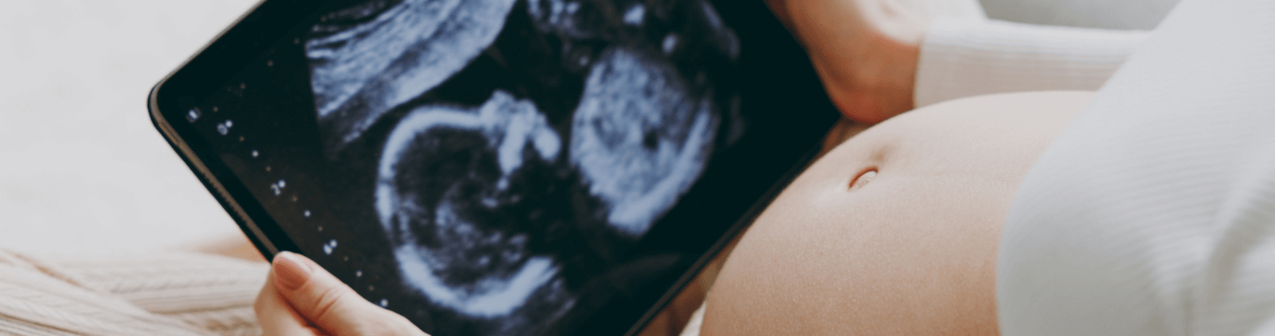 Kings Fertility Services - Surrogacy